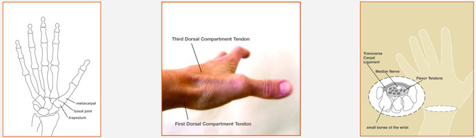 Common Hand Conditions